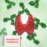 Autoimmune Thyroid Disorders <br>(e.g., Hashimoto’s, Graves’ Disease)